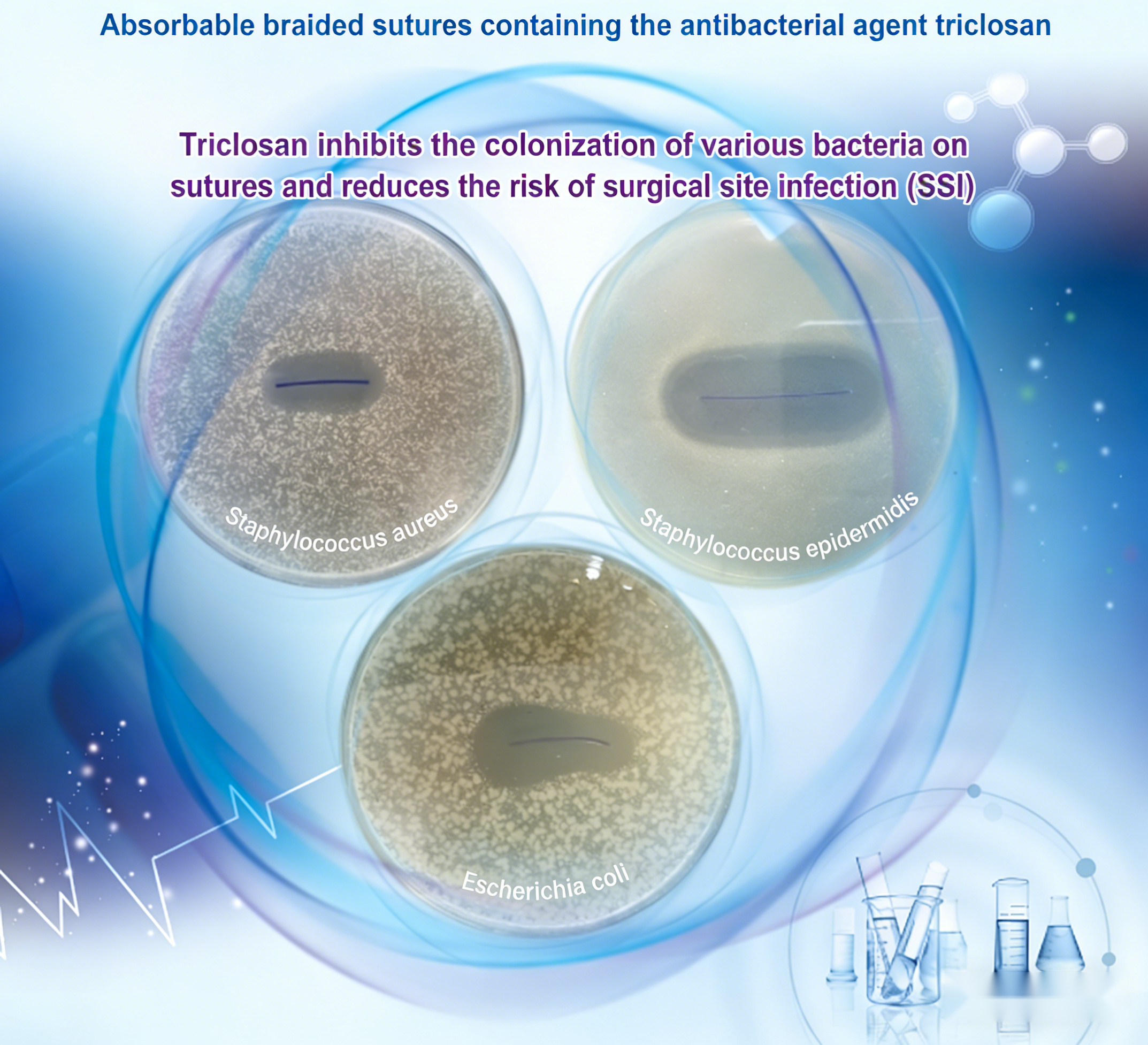 Antimicrobial suture